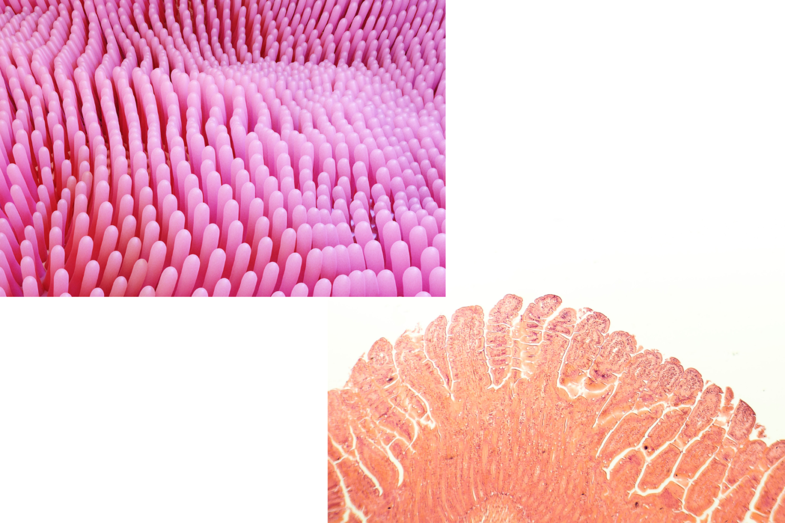 ヒスタミン不耐症の治療法は何ですか?